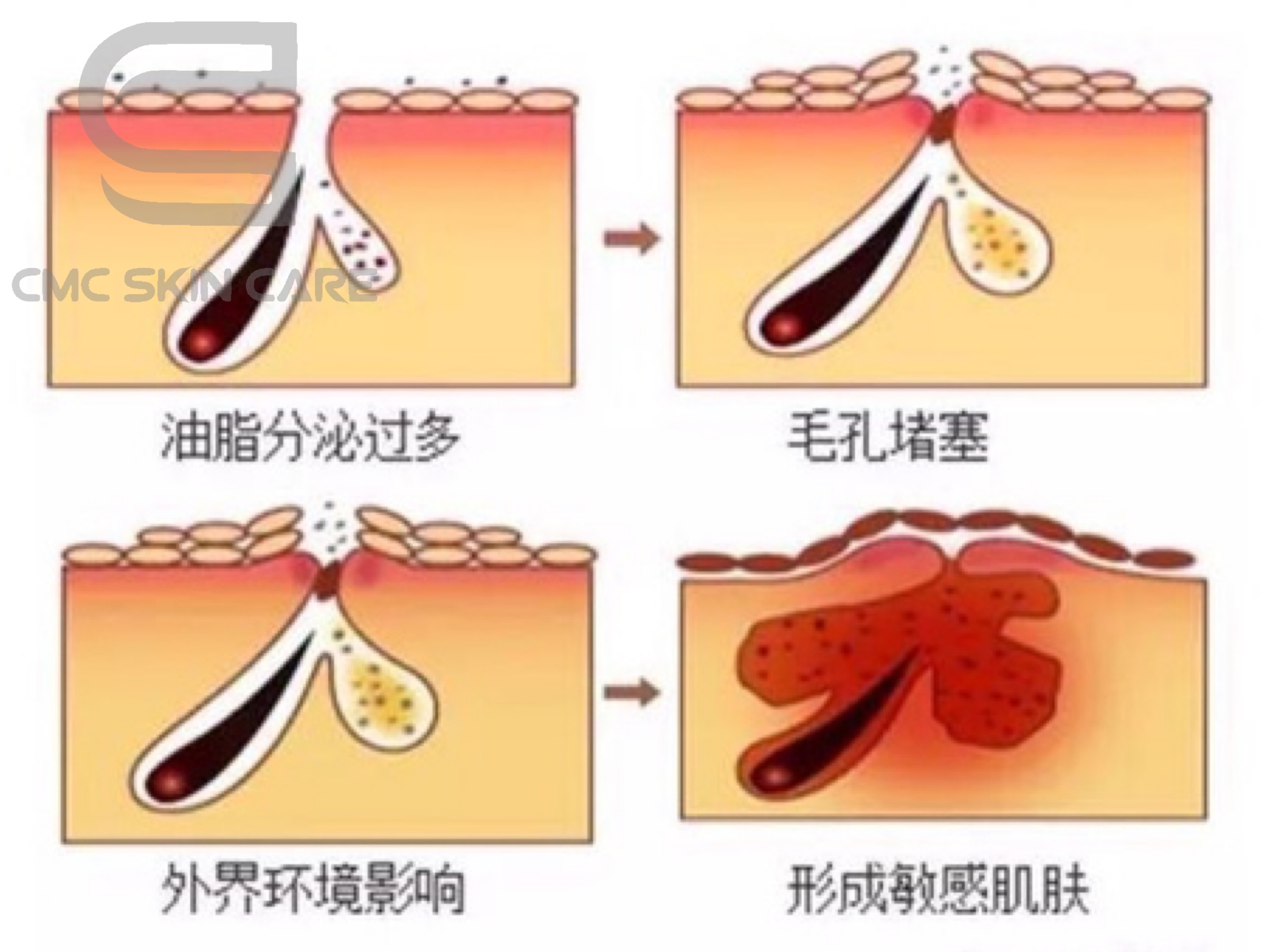 毛发类化妆品的成分及选择要点